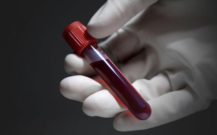 Российские ученые: анализ крови будет так же прост, как тест на беременность