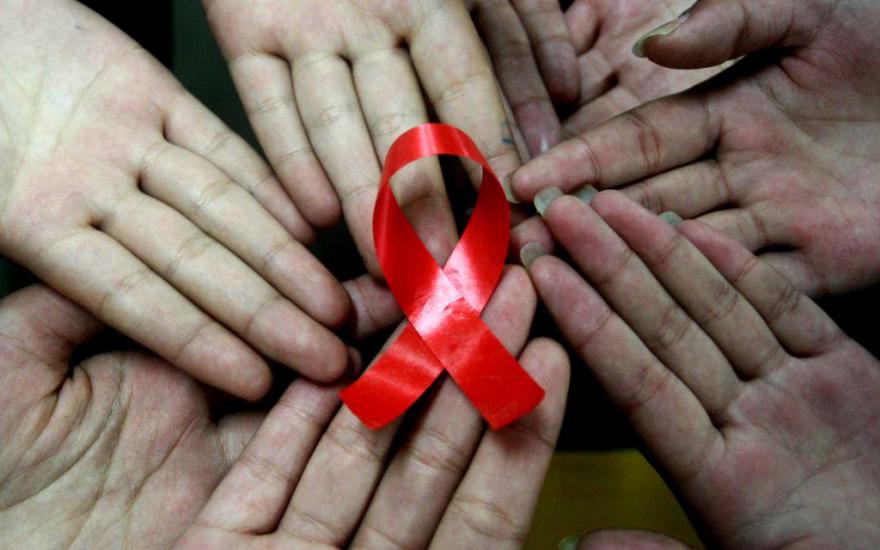 В Курганской области с начала года умерли 67 ВИЧ-инфицированных