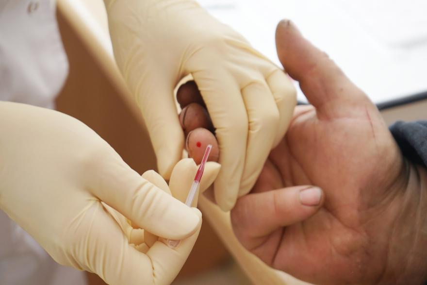 Курганцев приглашают бесплатно пройти тест на ВИЧ и гепатит
