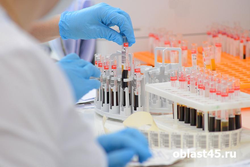 Российские ученые придумали домашний экспресс-тест на коронавирус